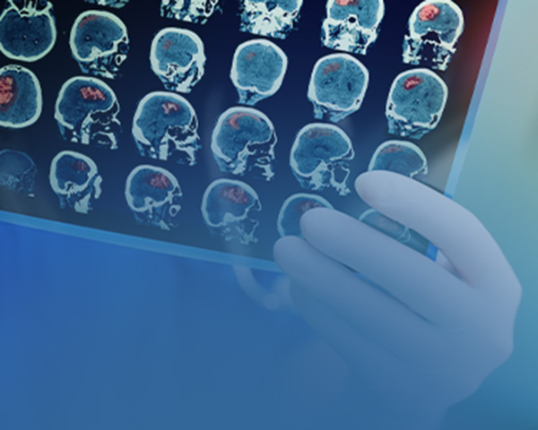 MRI